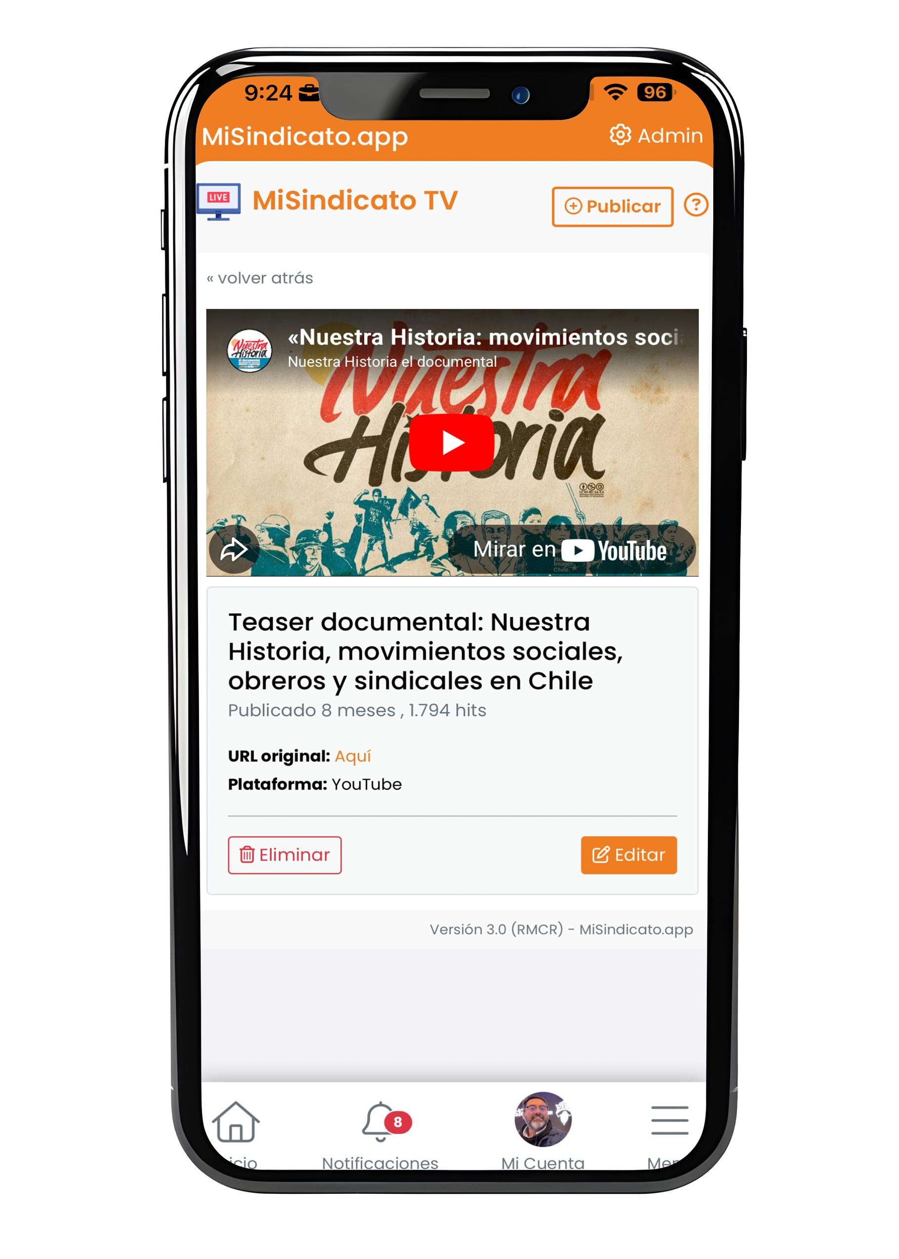 TVb